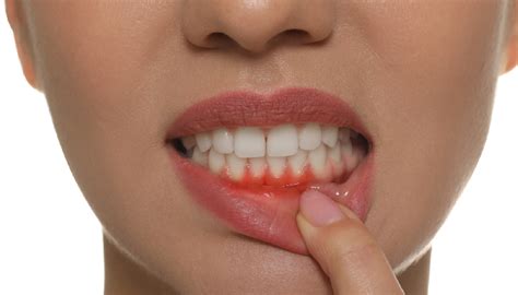 gum disease treatment near me